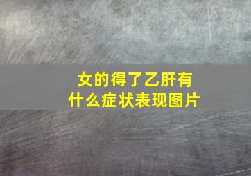 女的得了乙肝有什么症状表现图片