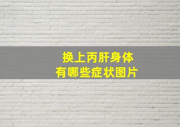 换上丙肝身体有哪些症状图片