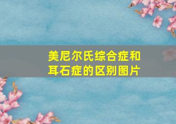 美尼尔氏综合症和耳石症的区别图片